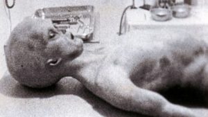 Инопланетянин на хирургическом столе